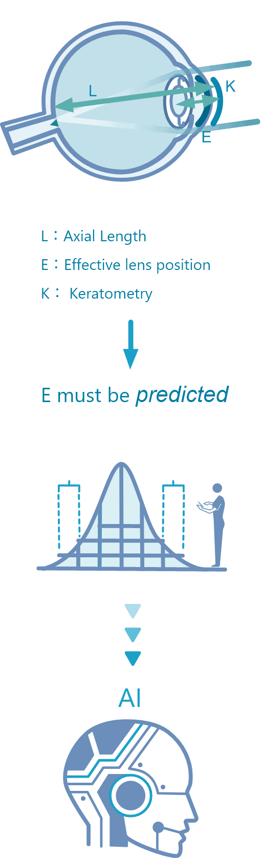 人工知能を組み合わせた眼内レンズ計算式